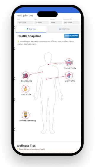 Digital report preview